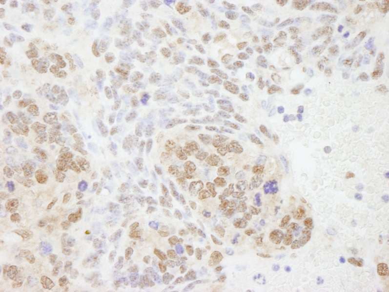 Polyclonal Rabbit anti-Human XPA Antibody (aa1-50, IHC)
