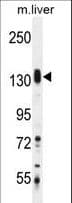 Polyclonal Rabbit anti-Human SASH1 Antibody (aa596-625, IHC, WB)