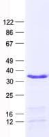 Human HOXD4 Protein (Recombinant His, N-Terminal)