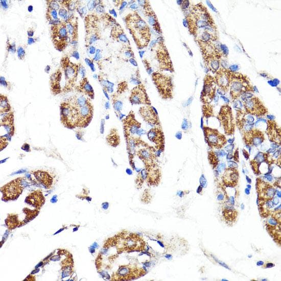 RNF149 Antibody