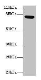 Polyclonal Rabbit anti-Human LHCGR / LHR / LH Receptor Antibody (aa27-362, WB)