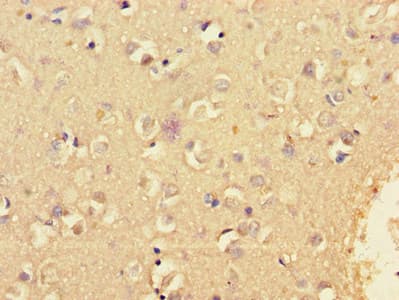 KCNIP4 / KCHIP4 Antibody