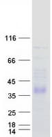 Human DHRS1 Protein (Recombinant Myc-DDK (Flag))