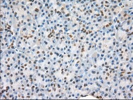 H6PD / G6PDH Antibody (clone OTI2C12)