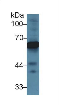 Alpha-Fetoprotein Antibody (aa409-611)
