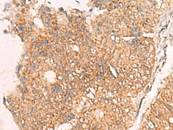 MOB1A Antibody