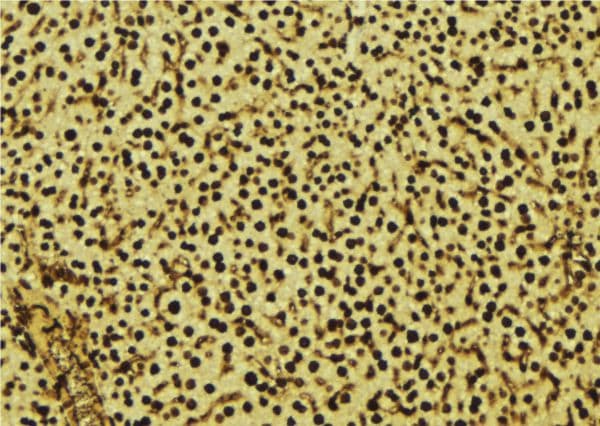 Polyclonal Rabbit anti-Human OPRS1 / SIGMAR1 Antibody (IHC, WB)