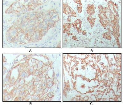 KRT8 / CK8 / Cytokeratin 8 Antibody (Amino Acid: 391-483, clone 8A5D12)
