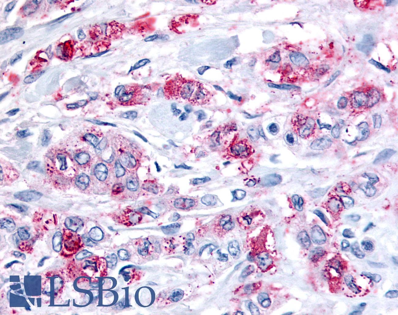PathPlus™ FFAR2 / GPR43 Antibody (Extracellular Domain)
