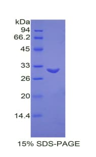 Mouse MFGE8 /Lactadherin Protein (Recombinant His)