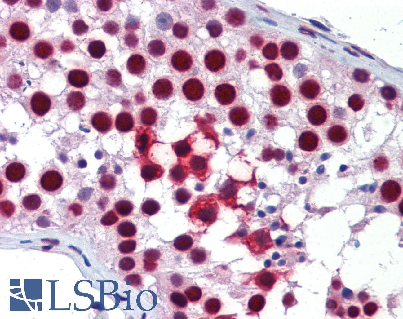 Polyclonal Rabbit anti-Human KHDRBS1 / SAM68 Antibody (aa359-408, IHC, WB)