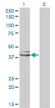 IHC-plus™ Monoclonal Mouse anti-Human GPN1 / XAB1 Antibody (clone 3E1, IHC, IF, WB)