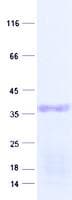 Human HOXC12 Protein (Recombinant His, N-Terminal)