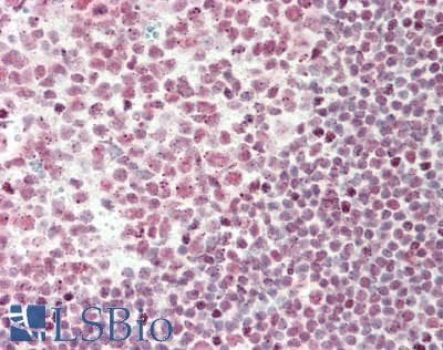 IHC-plus™ Polyclonal Rabbit anti-Human TAF15 Antibody (aa175-225, IHC, WB)