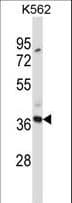 CLEC7A / Dectin 1 Antibody (aa70-98)