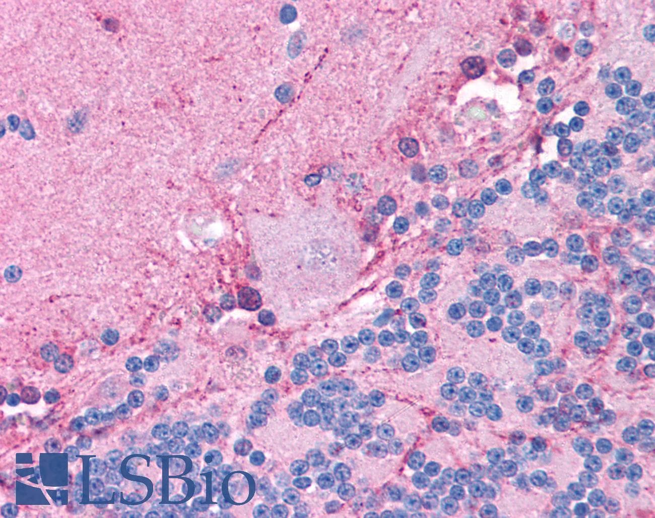 CLIC6 Antibody (aa435-484)