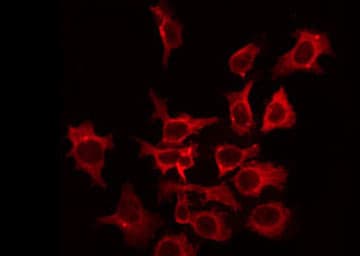 KCNC2 / Kv3.2 Antibody