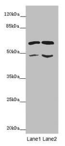 ST3GAL5 / GM3 Synthase Antibody