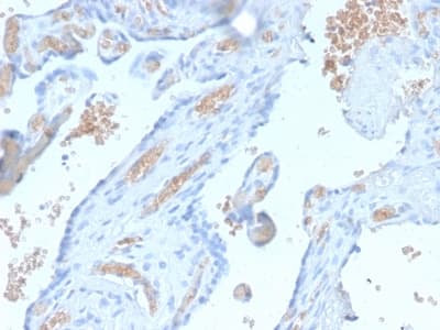 SPTA1 / Alpha Spectrin Antibody (aa356-475, clone SPTA1/2939R)