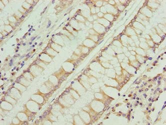 Polyclonal Rabbit anti-Human RFESD Antibody (IHC)