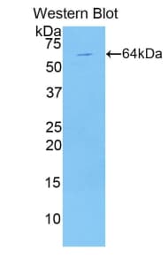 KIR2DL1 / CD158a Antibody (aa22-348)