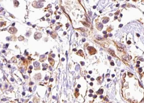 Polyclonal Rabbit anti-Human AKT2 Antibody (phospho-Ser474, IHC, IF, WB)