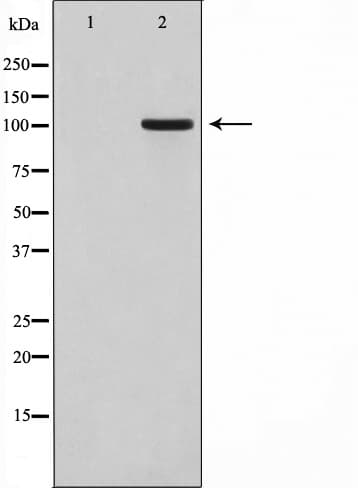 GPRIN1 / GRIN1 Antibody