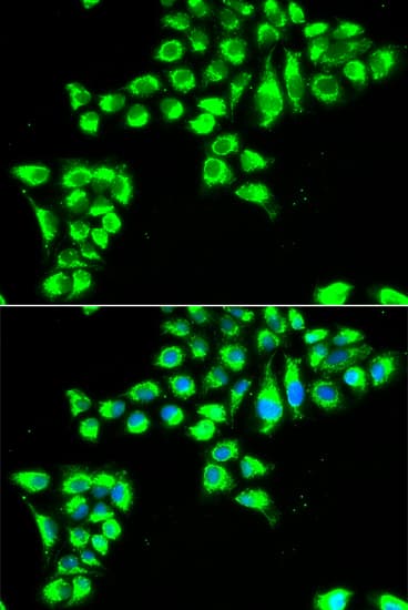 CLDN2 / Claudin 2 Antibody