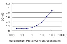 IHC-plus™ CREB1 / CREB Antibody (clone 3F1-1B2)