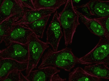 MKI67 / Ki67 Antibody (clone PMKI67-1)