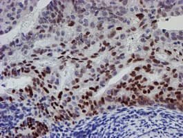 UBE2E3 Antibody (clone OTI4B4)