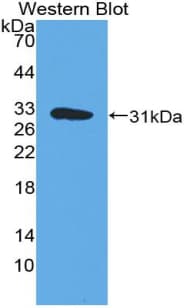 NFKBIB / IKB Beta / IKBB Antibody (aa85-332)