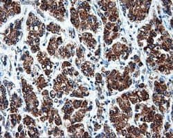 ATP5B / ATP Synthase Beta Antibody (clone OTI6C4)