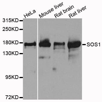 SOS1 Antibody