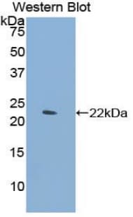 CLEC4M / L-SIGN / CD299 Antibody (aa242-399)