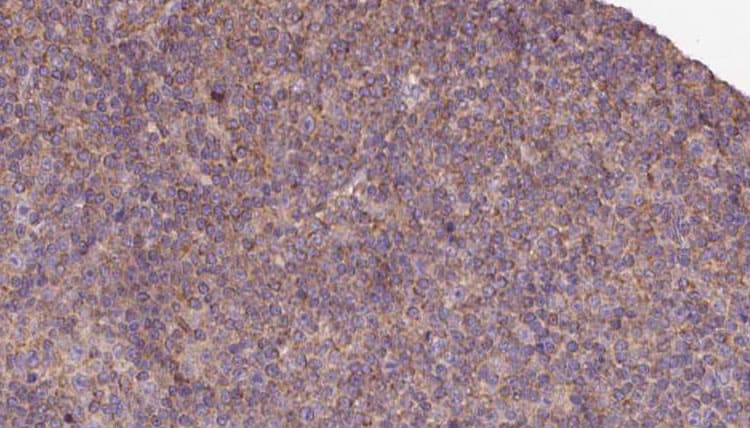 Polyclonal Rabbit anti-Human KIF12 Antibody (IHC, WB)