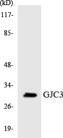 GJC3 / GJE1 Antibody (aa142-191)