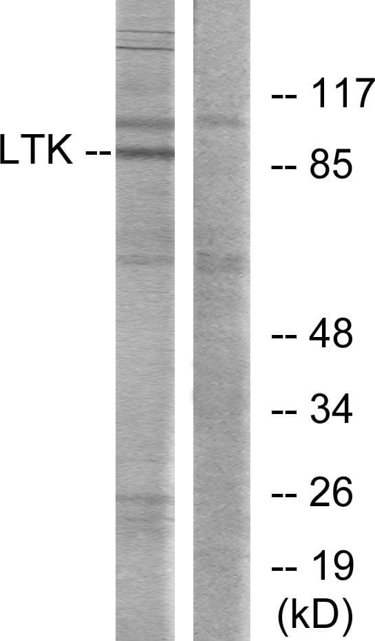 LTK Antibody