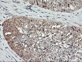 ASCC1 Antibody (clone OTI6G5)