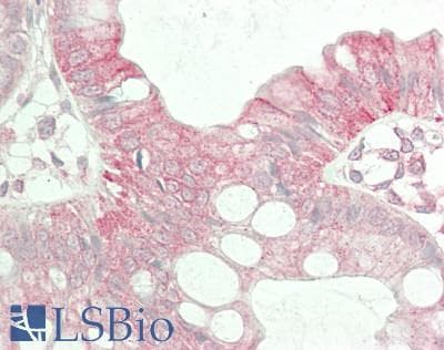 ABCB2 / TAP1 Antibody (aa504-553)