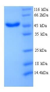 Mouse Serpina3n Protein (Recombinant His, N-Terminal)