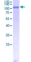 Human FSCN1 / Fascin Protein (Recombinant GST, N-terminus)