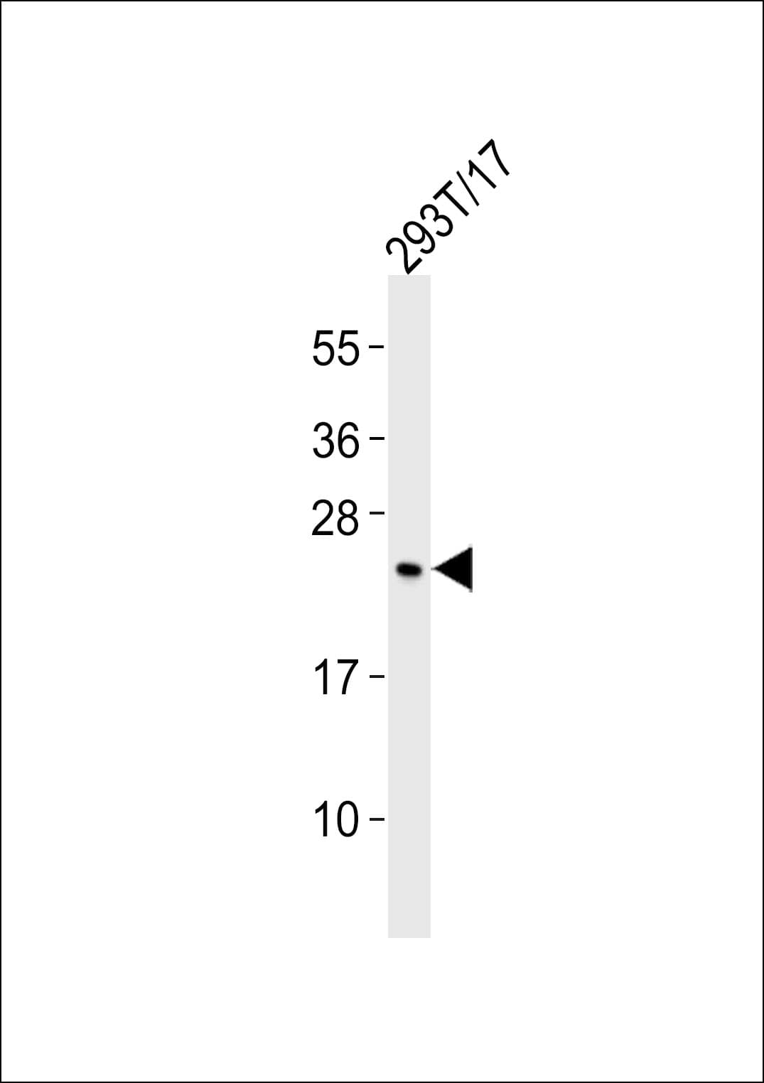 Polyclonal Rabbit anti-Human SCN2B Antibody (WB)
