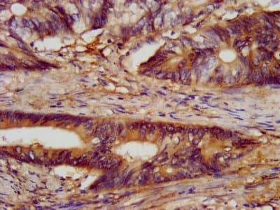 Polyclonal Rabbit anti-Human CLN5 Antibody (IF)