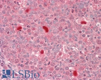 IHC-plus™ Polyclonal Rabbit anti-Human SQSTM1 Antibody (aa325-375, IHC, WB)