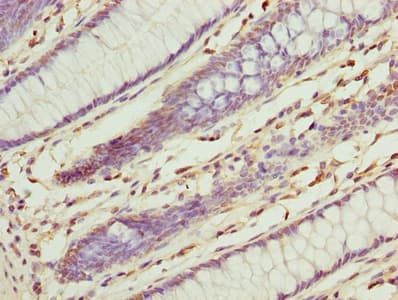 ILVBL Antibody