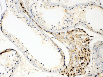 Polyclonal Rabbit anti-Human TECTA Antibody (IHC, WB)