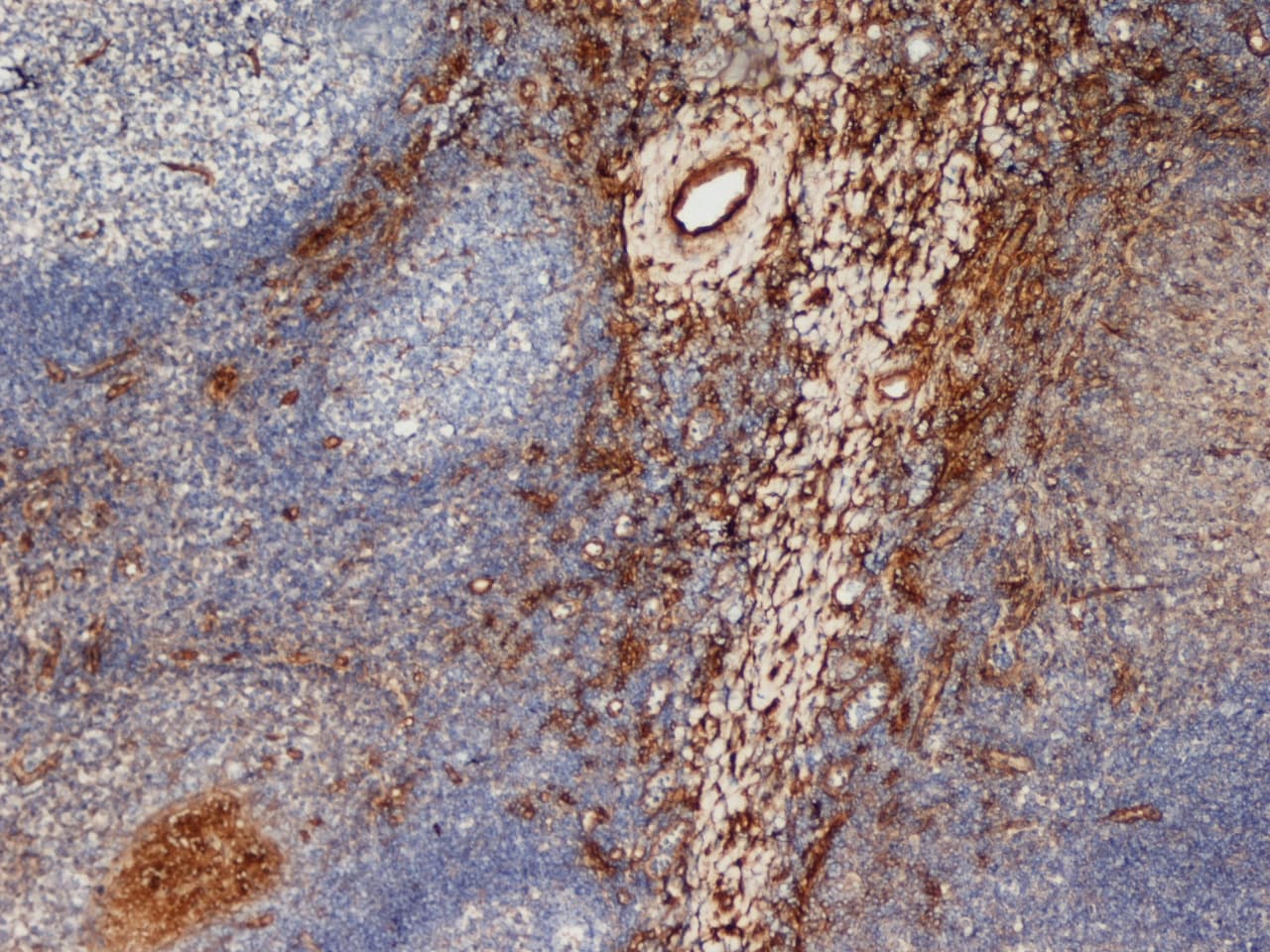 Monoclonal Mouse anti-Human Mannose Receptor / CD206 Antibody (clone 7-450, IHC)