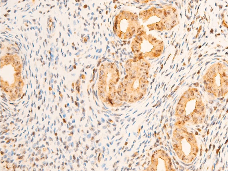 PDPK1 / PDK1 Antibody (phospho-Ser241)