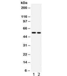 Polyclonal Rabbit anti-Human CSTA / Cystatin A Antibody (IHC, WB)